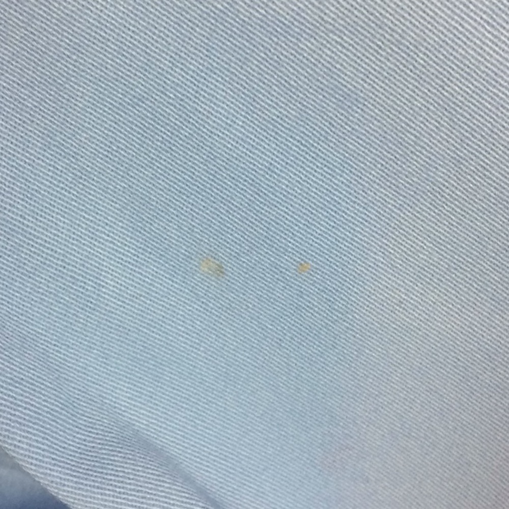 🟣Capris - Picture 2 of 6